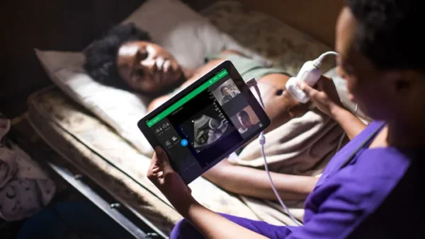 Lumify lectura ecografo tablet movil